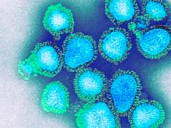 பீகாரின் முதல் H3N2 பெண் நோயாளி குணமடைந்தார்: சுகாதார அதிகாரிகள் தகவல்