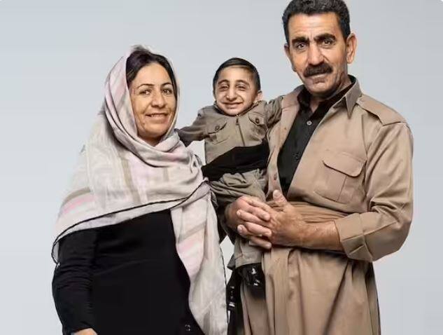 ਸਮਾਈਲ ਤੋਂ ਪਹਿਲਾਂ ਸਭ ਤੋਂ ਛੋਟੇ ਆਦਮੀ ਦਾ ਰਿਕਾਰਡ ਕੋਲੰਬੀਆ ਦੇ 36 ਸਾਲਾ ਐਡਵਰਡ 'ਨੀਨੋ' ਹਰਨਾਂਡੇਜ਼ ਦੇ ਨਾਂ ਸੀ।