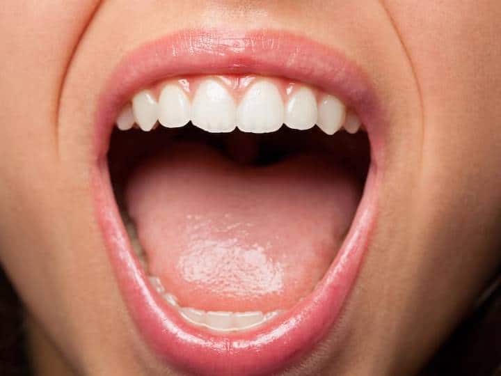 मुंह में होने वाले सफेद छाले शरीर में होने वाली इन गंभीर बीमारियों का देती हैं संकेत, वक्त रहते करवाएं इलाज