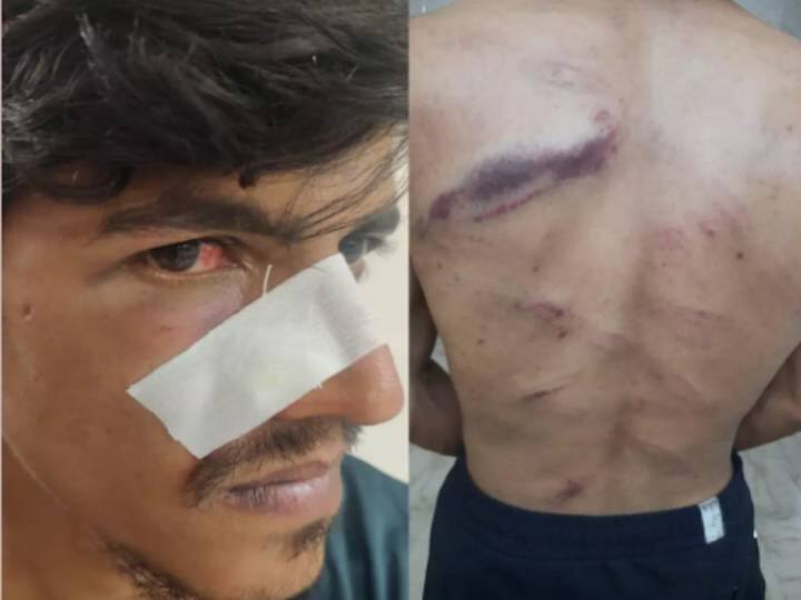 complaint against girlfriend-relatives for supporting actor kidnapping and assaulting  in love dispute Crime: காதல் விவகாரம்.. பேச வரச்சொல்லி கடத்தி தாக்கப்பட்ட சினிமா துணை நடிகர்.. திருவள்ளூரில் அதிர்ச்சி சம்பவம்..!