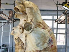 Harsh Goenka Shares Picture Of Blue Whale's Heart Weighing 181 Kg, Internet Is Amazed
