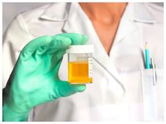 क्या सही में यूरिन पीना या इसे स्किन पर लगाना अच्छा होता है? जान लीजिए ये बात कितनी सही है