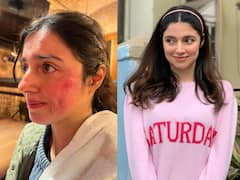 మూవీ షూటింగ్‌లో ప్రమాదం - నటి దివ్యకు ముఖంపై గాయాలు