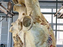 ​सोशल मीडिया पर तेजी से वायरल हो रहा ब्लू व्हेल का दिल, आपने देखा?