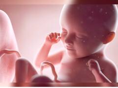 AIIMS के डॉक्टर्स ने '90 सेकंड' में कर दिया पेट में पल रहे बच्चे का ऑपरेशन, जानिए किस तरह हुई ये सर्जरी?