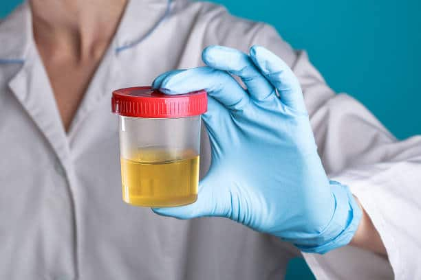 Urine Therapy : लघवीचं सेवन केल्याने जखमा आणि बद्धकोष्ठता यांसारखे आजार बरे होतात असा दावा काही रिपोर्टमध्ये करण्यात आला आहे. (PC:istockphoto)