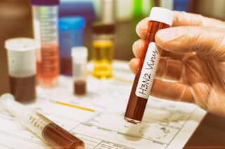 चिंताजनक! H3N2 वर औषधं उपलब्ध नाही, काळजी घ्या; आरोग्य मंत्र्यांचं आवाहन