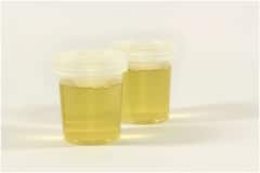 Urine: మీ మూత్రం రంగు మీకున్న ఆరోగ్య సమస్యల గురించి చెప్పేస్తుంది