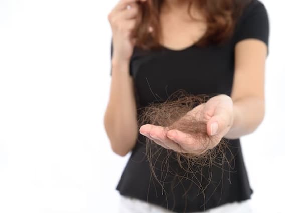 Hair Loss: नारियल, भृंगराज और प्याज बालों का झड़ना कैसे कम करते हैं, जानें लगाने का सही तरीका Hair Loss: नारियल, भृंगराज और प्याज बालों का झड़ना कैसे कम करते हैं, जानें लगाने का सही तरीका
