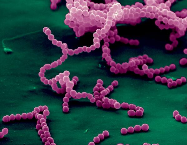 रुग्णालयात मुलाची तपासणी केली. तपासणीमध्ये डॉक्टरांना मुलाच्या शरीरात विचित्र संसर्ग झाल्याचं आढळून आलं. त्यानंतर मुलाला त्वरीत आयसीयूमध्ये दाखल करण्यात आलं.