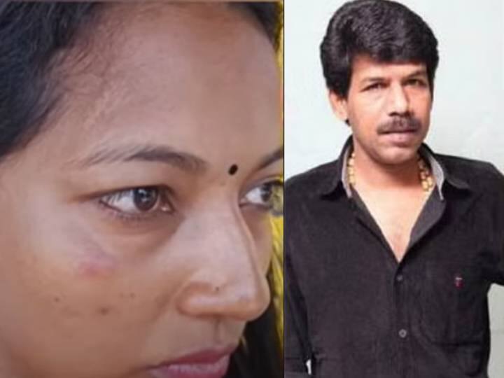 Supporting actress attacked in Director Bala's Vanangaan shooting spot Vanangaan: பாலாவின் “வணங்கான்” படப்பிடிப்பில் பஞ்சாயத்து.. பழுத்தது துணை நடிகையின் கன்னம்.. ரசிகர்கள் அதிர்ச்சி 