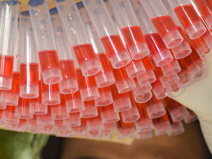 coronavirus: 71 new cases of surfaced in mumbai on wednesday Mumbai Corona Update: मुंबई में कोरोना संक्रमण के 71 नए मामले, एक्टिव केस की संख्या 350 के पार