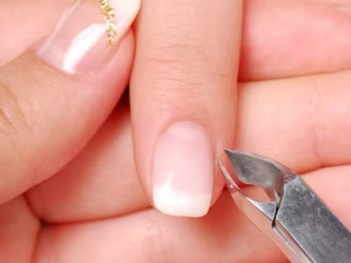 Natural Homemade Remedies to Treat the Peeling Skin Around Your Nails नाखून के आसपास निकल रहे स्किन को दांत से काटकर हटाने की भूल न करें, बल्कि ऐसे करें इलाज नहीं तो बड़ी बीमारी का ले लेगी रूप