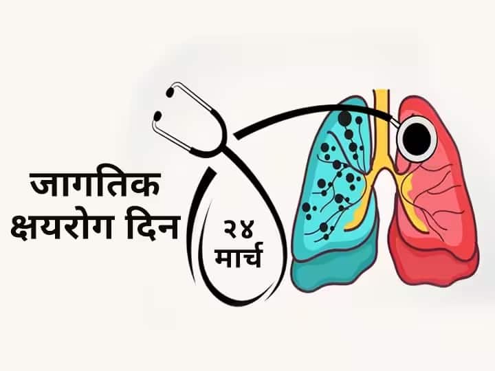 World TB Day 2023 know history importance and theme of the day marathi news World TB Day 2023 : आज जागतिक क्षयरोग दिन; जीवघेण्या'TB'शी लढाई, काय आहे यंदाची थीम? वाचा सविस्तर