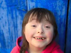 नवजात में दिख रही है यह अजीब से लक्षण तो समझ जाइए डाउन सिंड्रोम से पीड़ित है आपका बच्चा