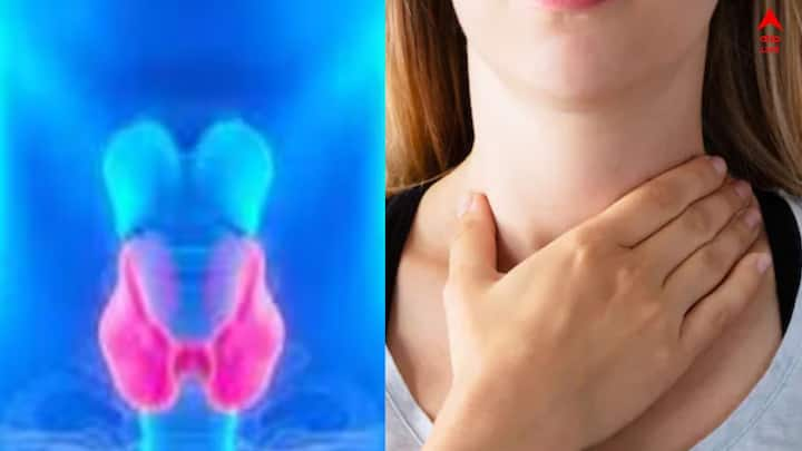 Thyroid Care Updates: হাইপোথাইরয়েডিজম ঘটে, যখন  আপনার থাইরয়েড গ্রন্থি নিষ্ক্রিয় থাকে।  যে টিপসগুলি না জানলেই নয়, চলুন জেনে নেওয়া যাক।