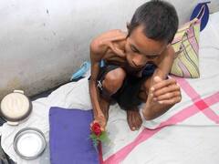 World TB Day: Did You Know Weak Immune System Can Also Lead To Tuberculosis? Must Know All Symptoms