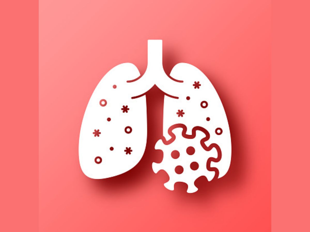 World Tuberculosis Day 2023 Is There Any Link Between Covid 19 And TB   91607528b12c428a13d540ebe9f531481679678071891324 Original 