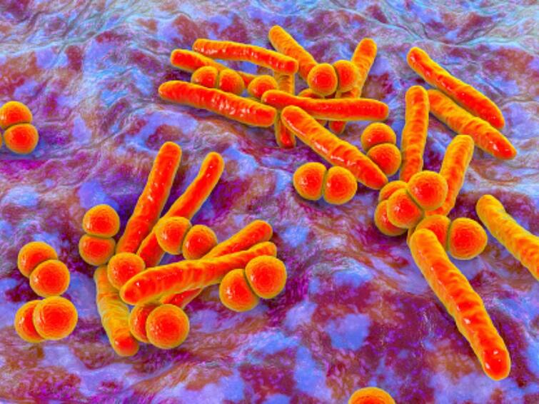 World Tuberculosis Day 2023 TB Can Affect Any Body Part One Quarter Of
