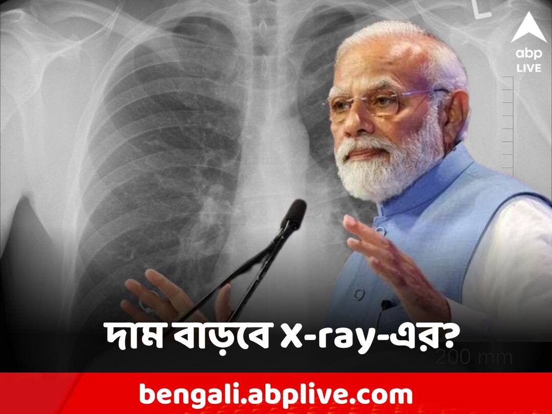 Modi govt hikes customs duty on import of these machines X-Ray: এবার এক্স-রে করতে গেলে খসবে বিশাল টাকা? একাধিক মেশিনে কাস্টম ডিউটি বৃদ্ধি করল মোদি সরকার