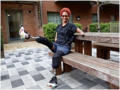 इस लड़की का डांस देख कभी थिरकते थे लोग, पर मच्छर ने बना दिया अपाहिज!