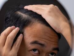 वो कौन-सा विटामिन है, जिसकी कमी से सिर के बाल झड़ने लगते हैं? उसकी कमी से और क्या होता है