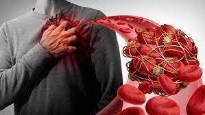 if you feel this symptoms tis may be blood clot sign Blood Coagulates: જો શરીરમાં આ લક્ષણો અનુભવાય તો બ્લડ ક્લોટના છે સંકેત, વધી શકે છે હાર્ટ અટેકનું જોખમ