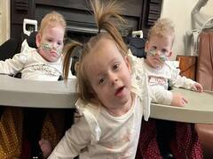 British Triplets Create Guinness World Record As Most Premature Birth