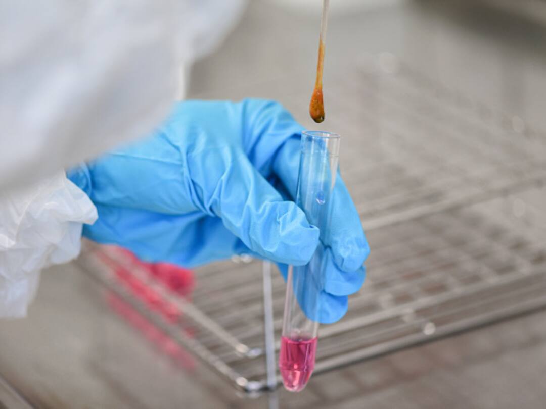 Chile Reports First Case Of Bird Flu In Human Chile Reports First Case Of Bird Flu In Human