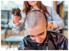 क्या एक बार गंजा हो जाने से बाल अच्छे आने लगते हैं... इस बात में कितनी सच्चाई है?