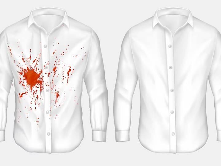 These 5 Effective Steps Will Help You Remove Turmeric Stains