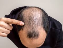 Hair Fall Control Tips: ਕੀ ਤੁਸੀਂ ਵਾਲਾਂ ਦੇ ਝੜਨ ਤੋਂ ਹੋ ਪਰੇਸ਼ਾਨ? ਤਾਂ ਅਪਣਾਓ ਇਹ ਤਰੀਕੇ...ਕਦੇ ਨਹੀਂ ਝੜਨਗੇ ਵਾਲ