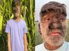 Werewolf Syndrome: ਇਹ ਕਿਦਾਂ ਦੀ ਬਿਮਾਰੀ... ਜਦੋਂ ਨੱਕ, ਕੰਨ, ਅੱਖਾਂ 'ਤੇ ਵੀ ਉੱਗ ਜਾਂਦੇ ਹਨ ਵਾਲ! ਕੁਝ ਅਜਿਹੀ ਹੁੰਦੀ ਹਾਲਤ
