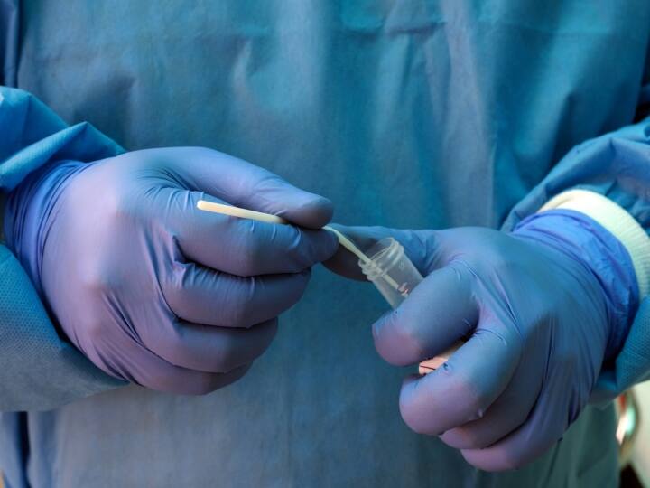 Coronavirus Cases More than 400 Covid-19 cases found in Delhi Second day One Patient Died Positivity rate crossed 16 percent Coronavirus Cases in Delhi: दिल्ली में लगातार दूसरे दिन आए कोरोना के 400 से ज्यादा मामले, एक मरीज की मौत, संक्रमण दर 16 प्रतिशत के पार