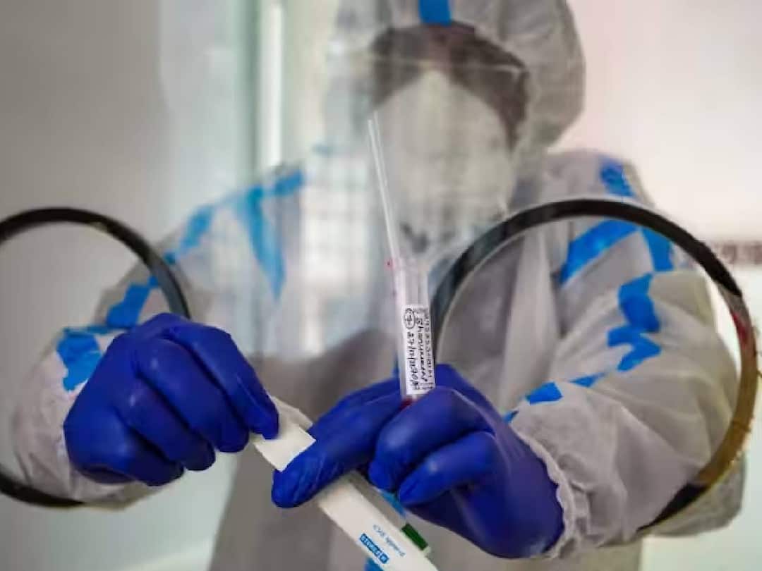 According to the Tamil Nadu Health Department, 1,086 people have been confirmed to be infected with the corona virus and are being treated. TN Corona Spike: தமிழ்நாட்டில் 1000-ஐ கடந்த கொரோனா தொற்று பாதிப்பு.. கட்டாயமாகும் முகக்கவசம்?