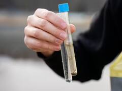 पानी ने ही पहुंचा दिया अस्पताल, बेल्लारी में 21 लोग बीमार, डॉक्टर बोला- हर दिन आ रहे 4-5 केस