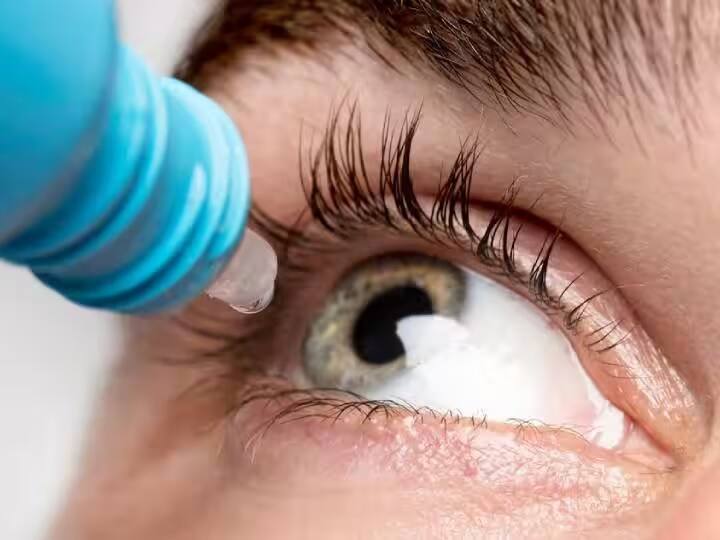 Prevention of Blindness Week 2023: indians suffered max damage to eyesight Blindness: ભારતની અડધીથી વધુ વસ્તીની આંખોમાં છે સમસ્યા.... જાણો આવું કેમ, ને કઇ રીતે આનાથી બચી શકાશે ?