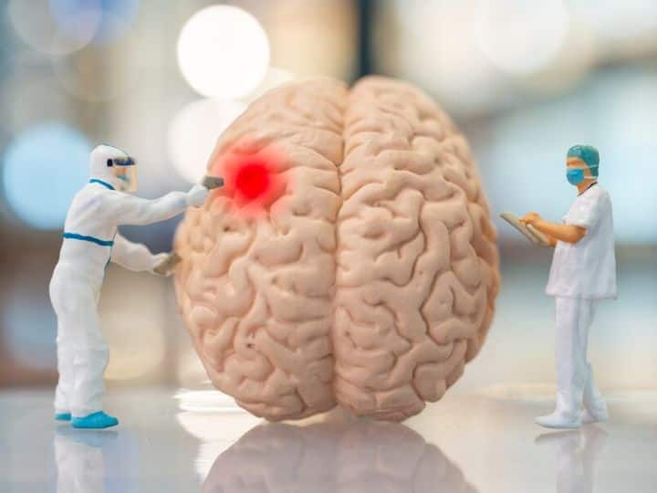 कोविड-19 की चपेट में आए ब्रेन स्ट्रोक के मरीजों में मौत का खतरा ज्यादा: स्टडी Death Rate Higher Among Brain Stroke Patients With Covid-19 Claim Study कोविड-19 की चपेट में आए ब्रेन स्ट्रोक के मरीजों में मौत का खतरा ज्यादा: स्टडी