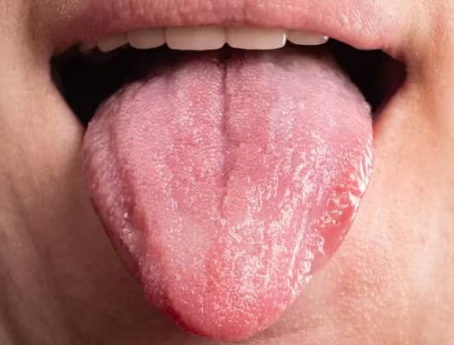 tongue-can-tell-about-these-diseases-find-out-how-healthy-you-are ਤੁਹਾਡੀ 'ਜੀਭ' ਖੋਲ੍ਹ ਸਕਦੀ ਹੈ ਕਈ ਬਿਮਾਰੀਆਂ ਦੇ ਰਾਜ, ਇਨ੍ਹਾਂ 5 ਗੱਲਾਂ ਨਾਲ ਲਾਓ ਆਪਣੀ ਸਿਹਤ ਦਾ ਪਤਾ