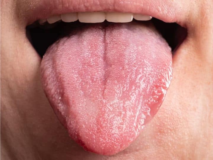 Tongue Can Tell About These Diseases Find Out How Healthy You Are आपकी 'जीभ' खोल सकती है कई बीमारियों के राज, इन 5 बातों से लगाएं अपनी सेहत का पता