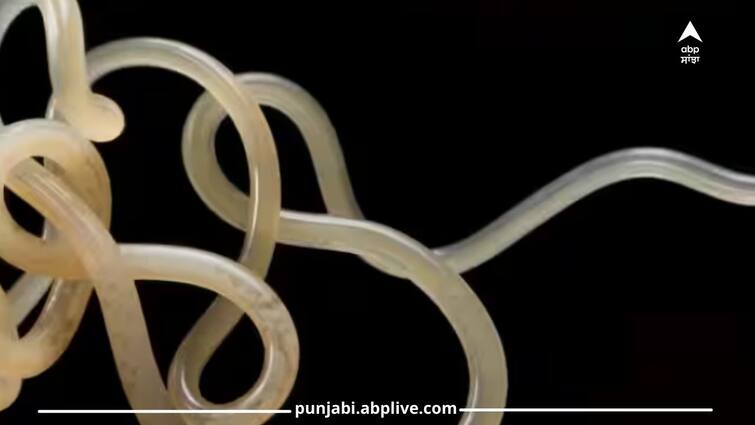 parasitic-worms-found-under-woman-skin-details-inside Shocking:ਔਰਤ ਦੀ ਸਕੀਨ ਵਿੱਚ ਘੁੰਮਦਾ ਨਜ਼ਰ ਆਇਆ ਇੱਕ ਵੱਡਾ ਕੀੜਾ...ਫਿਰ ਦਿਮਾਗ ਵਿੱਚ ਜਾ ਕੇ ਮਿਲਿਆ ! ਜਾਣੋ ਕਿਵੇਂ ਸਰੀਰ ਵਿੱਚ ਹੋਇਆ ਦਾਖਲ