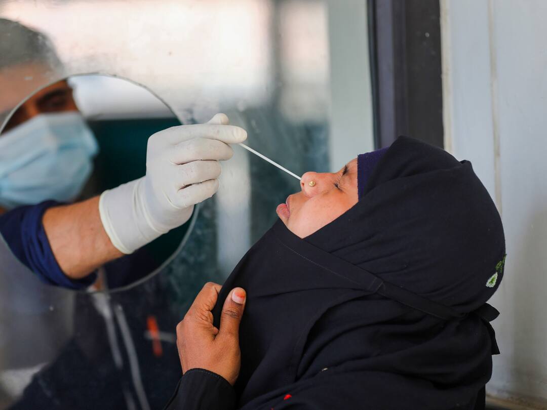 Coronavirus Cases Today Further Dip In Daily Infections 7633 New Covid Cases In 24 Hrs 61233 Active Caseload 6702 Recoveries Coronavirus Cases Today: Further Dip In Daily Infections. 7,633 New Covid Cases In 24 Hrs