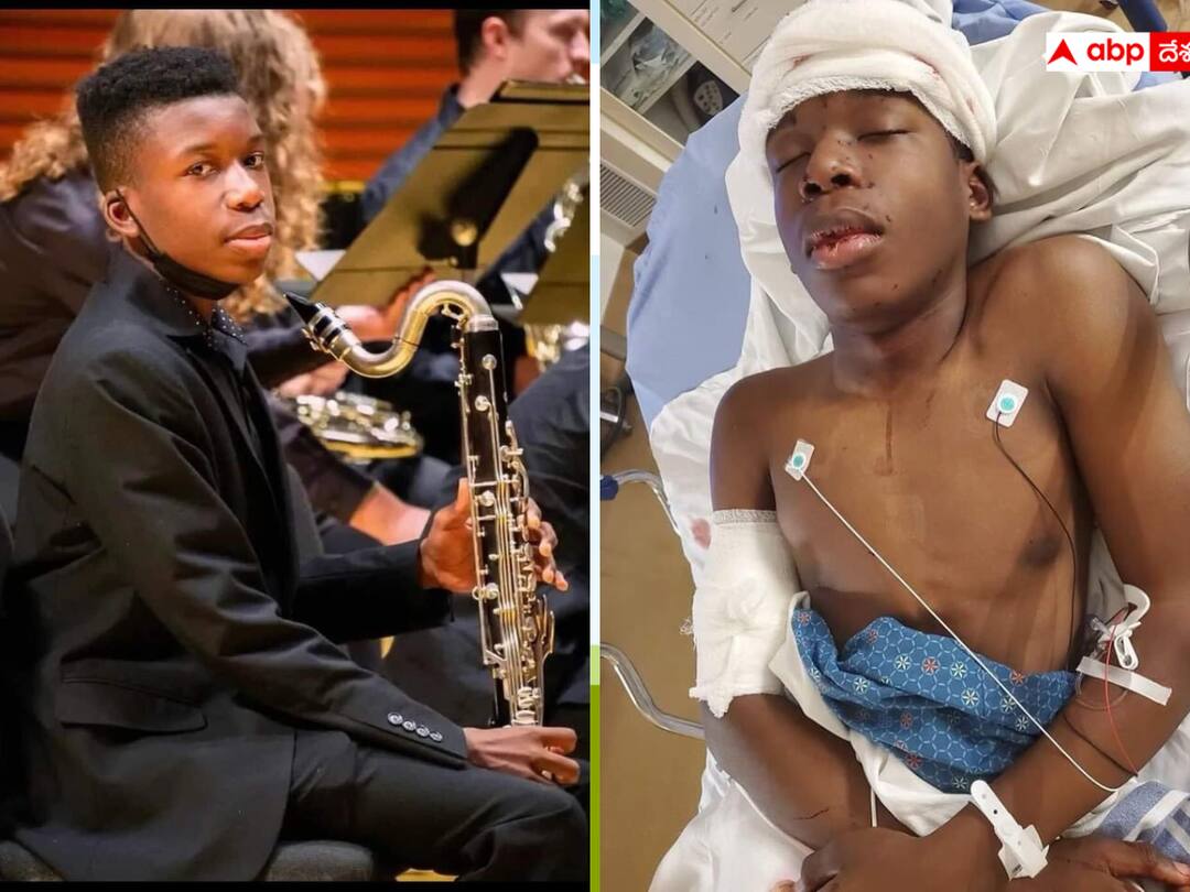 పొరపాటు డోర్బెల్ మోగించాడని నల్లజాతి యువకుడిపై కాల్పులు- అమెరికాలో వెలుగు చూసిన దారుణం Black Teen Shot Twice For Ringing Wrong Doorbell In US పొరపాటు డోర్బెల్ మోగించాడని నల్లజాతి యువకుడిపై కాల్పులు- అమెరికాలో వెలుగు చూసిన దారుణం