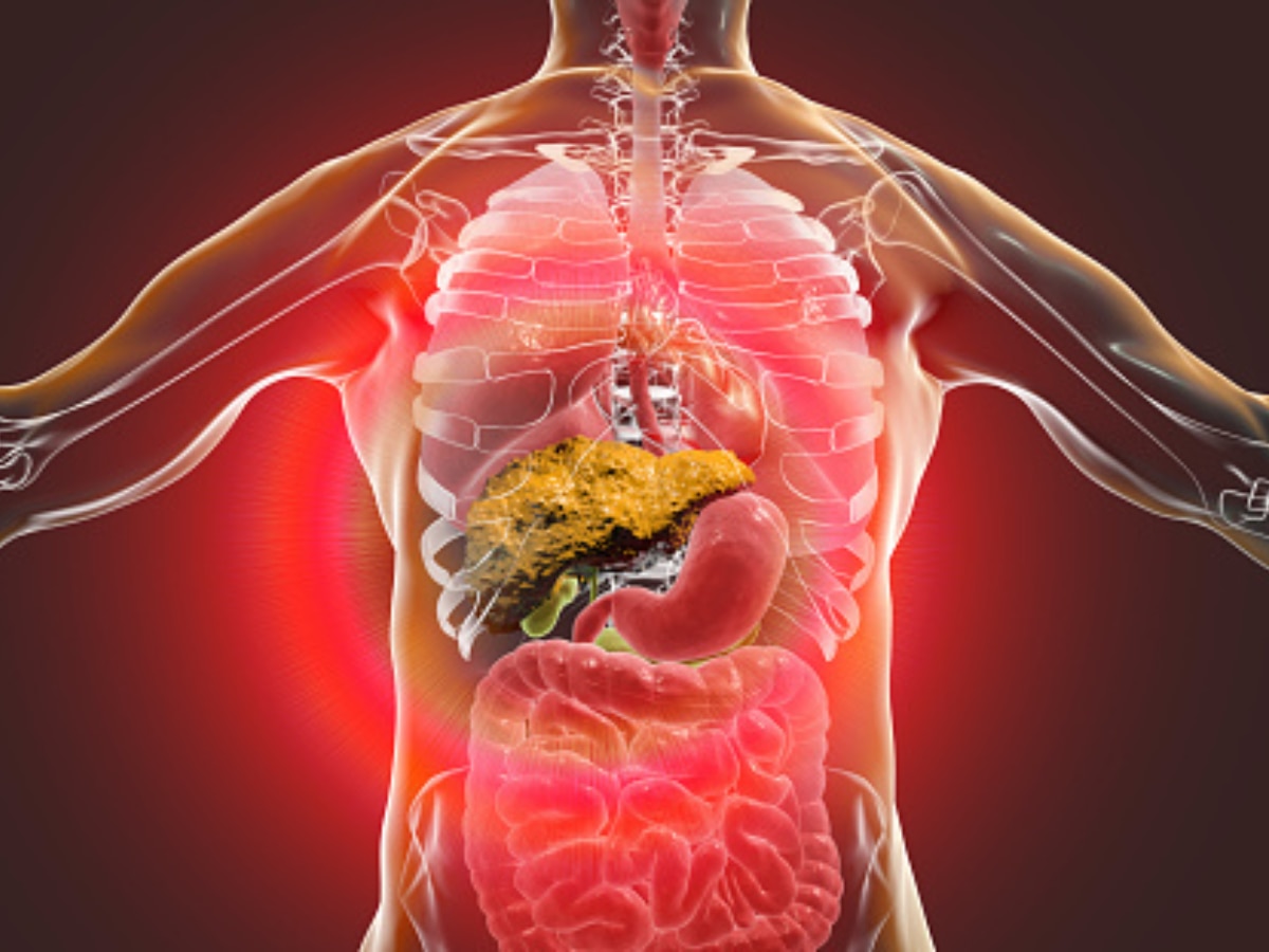 liver-cirrhosis-symptoms-causes-treatment-and-all-that-you-need-to