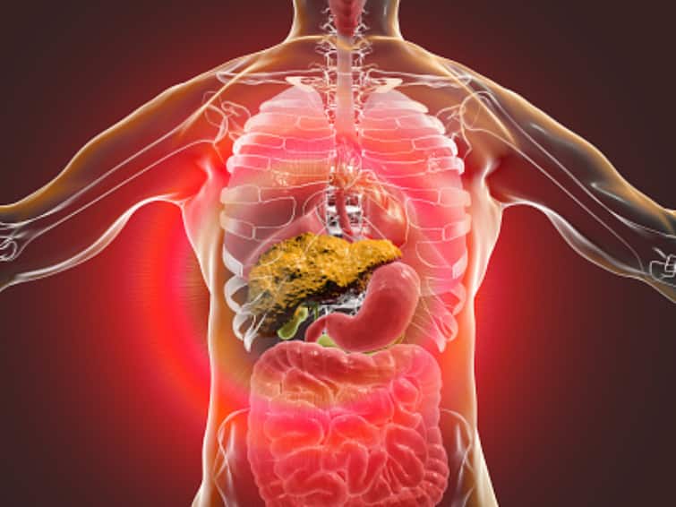 World Liver Day 2023 Liver Cirrhosis Symptoms Causes Treatment Risk Factors What Is Liver Cirrhosis Liver Cirrhosis: Symptoms, Causes, Treatment, And All That You Need To Know About It