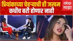 Priyanka Chopra Interview : चेहऱ्याचे विद्रुपीकरण कसे करते? तुम्ही Nick ला पाणीपुरी खाऊ घालता का?