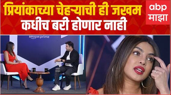 Priyanka Chopra Interview : चेहऱ्याचे विद्रुपीकरण कसे करते? तुम्ही Nick ला पाणीपुरी खाऊ घालता का?