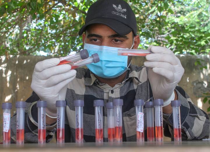 ANI সূত্রের খবর, AIIMS-এর প্রাক্তন ডিরেক্টর রণদীপ গুলেরিয়া বলেছেন, 'সারা দেশে নতুন করে কোভিড সংক্রমণ বাড়ছে। তবে এই সংক্রমণের অধিকাংশই মৃদু উপসর্গযুক্ত। হাসপাতালে ভর্তি হওয়ার ঘটনাও তেমন বাড়ছে না। এখন ভয়ের মতো পরিস্থিতি নেই।