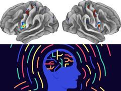 Link Between Body And Mind Is Embedded In Brain Structure, Scientists Find