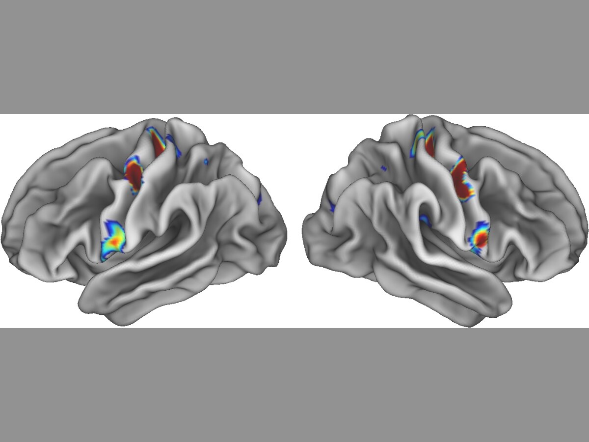 Link Between Body And Mind Is Embedded In Brain Structure, Scientists Find